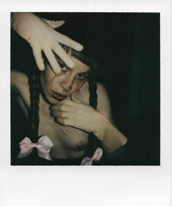 bb.apathy