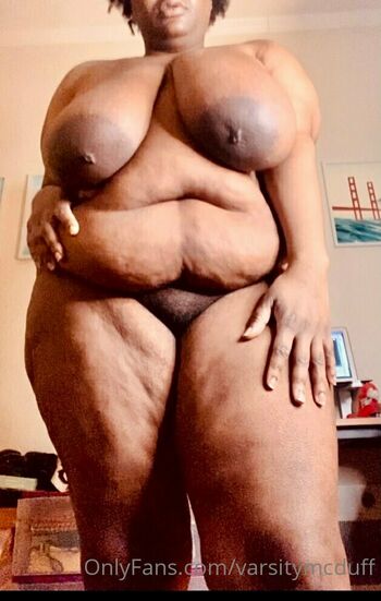 cherrycolaareola