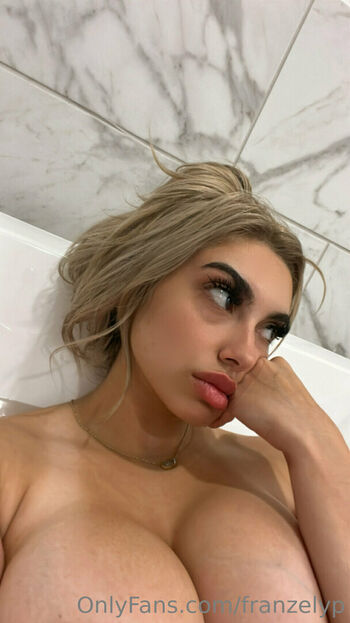 Franzelyp