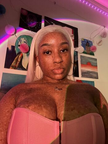 freckledn