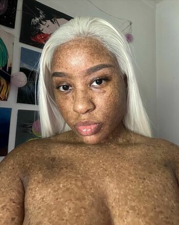 freckledn