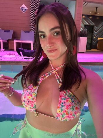 kenziemadisonxo