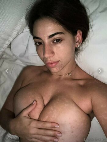 lysssavage