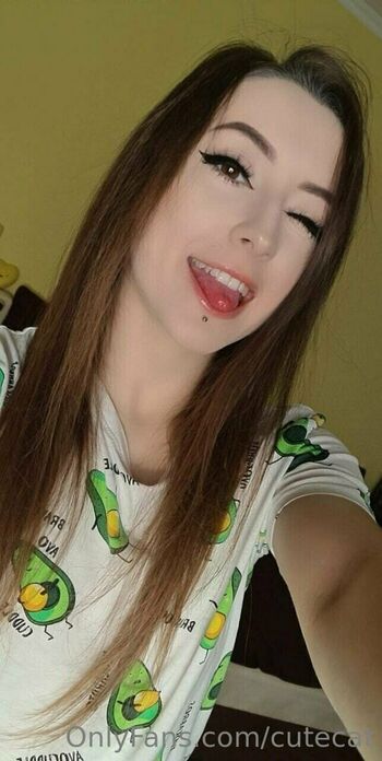 mi_ameli