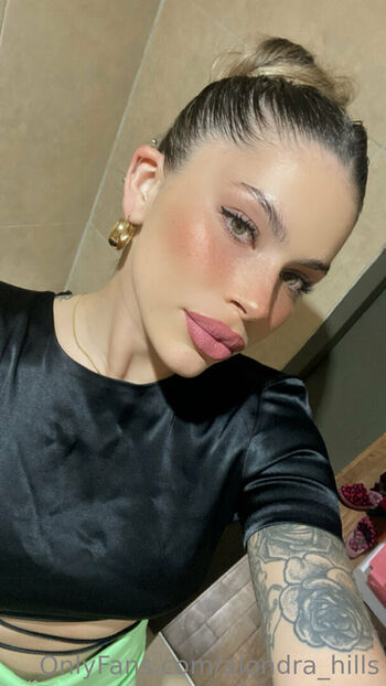 omalia