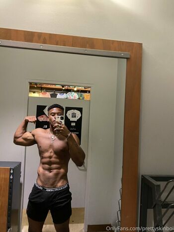 prettyskinboi