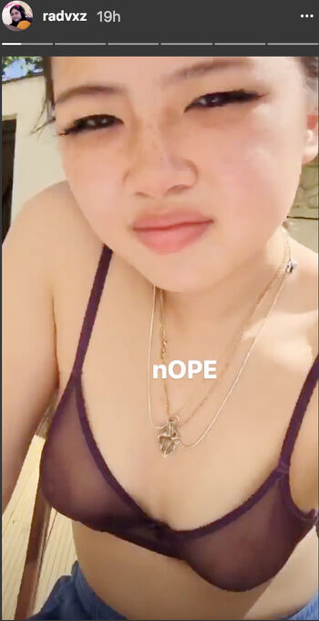 Radvxz