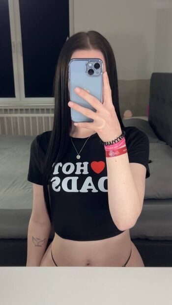 Request xlanaptrx