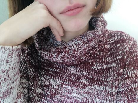 vitiligo95