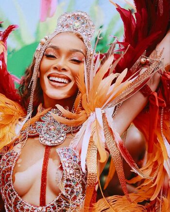 Winnie Harlow