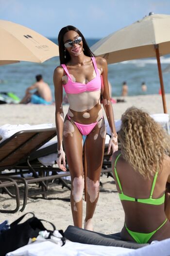 Winnie Harlow