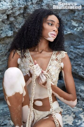 Winnie Harlow