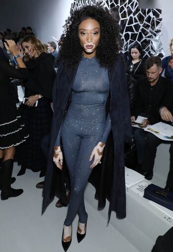 Winnie Harlow