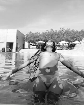 Winnie Harlow