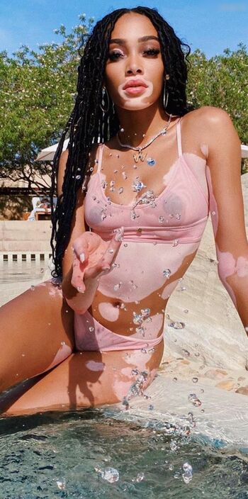 Winnie Harlow