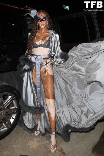 Winnie Harlow