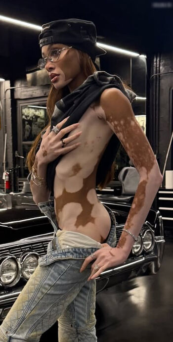Winnie Harlow