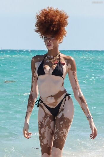 Winnie Harlow