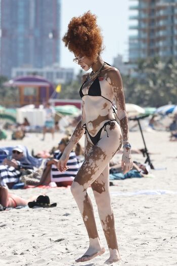 Winnie Harlow