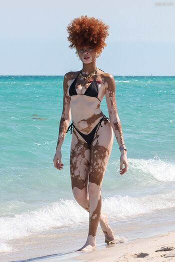 Winnie Harlow