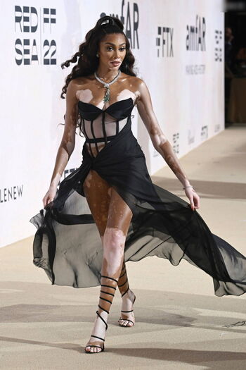 Winnie Harlow
