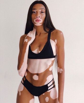 Winnie Harlow
