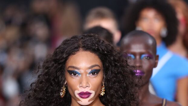Winnie Harlow