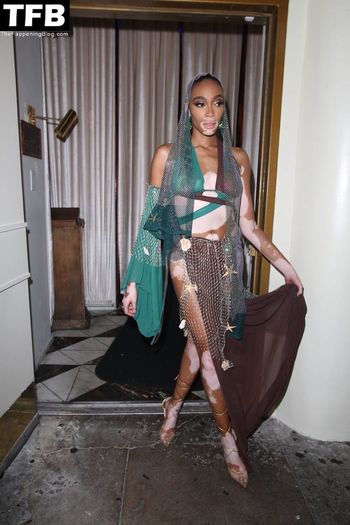 Winnie Harlow