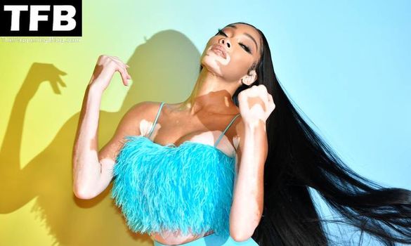Winnie Harlow
