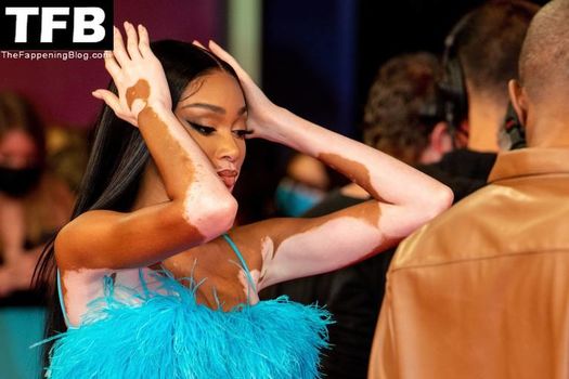 Winnie Harlow