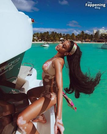 Winnie Harlow