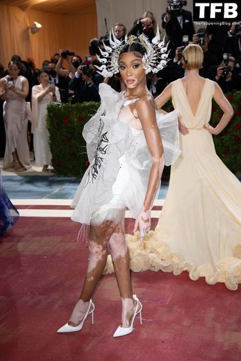 Winnie Harlow