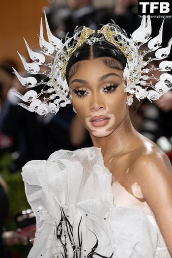 Winnie Harlow