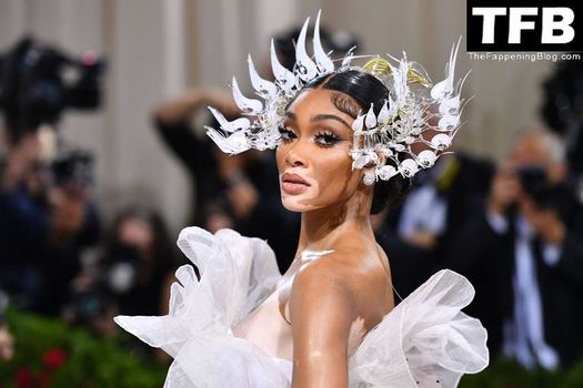 Winnie Harlow
