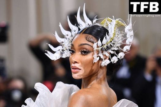 Winnie Harlow