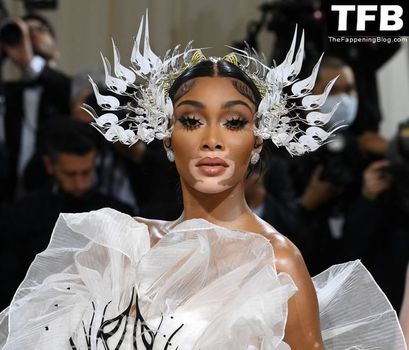 Winnie Harlow