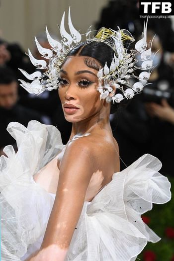 Winnie Harlow