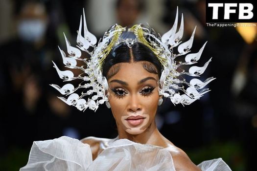Winnie Harlow