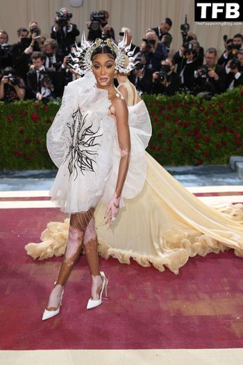 Winnie Harlow