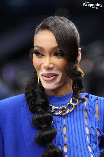 Winnie Harlow