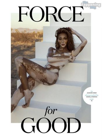Winnie Harlow