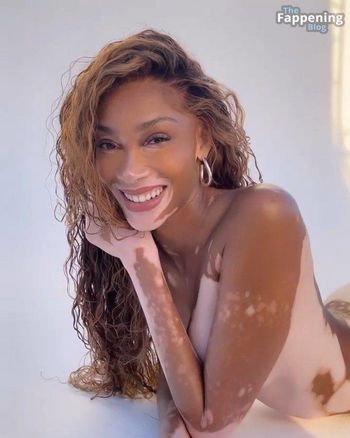 Winnie Harlow