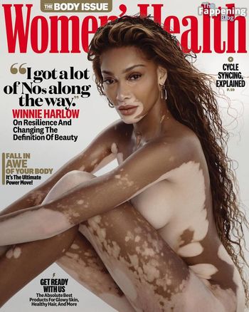 Winnie Harlow