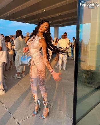 Winnie Harlow