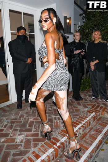 Winnie Harlow